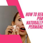 How to Remove Pimples Naturally and Permanently